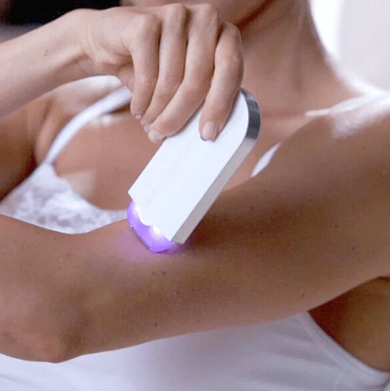 Pijnloze Laser Epilator Met Automatische Activatie Voor Zachte Ontharing